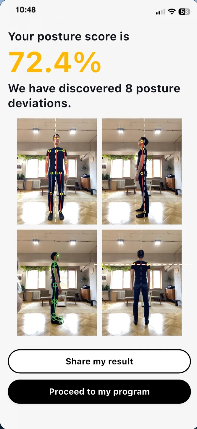 Postureletics posture-score result — 72.4%, with 8 detected deviations across four annotated photos.
